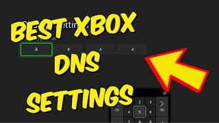 The BEST DNS Settings on Xbox One Network Easy Tutorial [upl. by Nosiram]