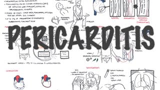 Pericarditis  Overview signs and symptoms pathophysiology diagnosis treatment [upl. by Anayik]