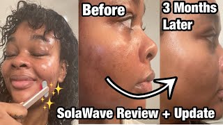 SolaWave Tutorial  SolaWave Review Before and After With Photos [upl. by Aira622]