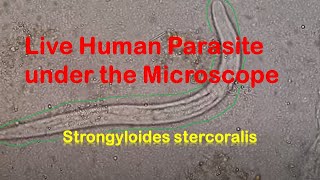 Human Parasites Live under the Microscope  Strongyloides stercoralis [upl. by Amor]