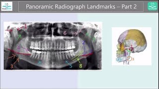 Panoramic Radiograph Landmarks Tutorial  Part 2 [upl. by Saxela]