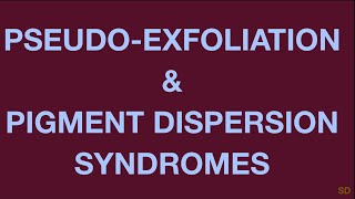 Glaucoma Session 15 Secondary Open Angle Glaucoma Part 1 Pseudoexfoliation Pigmentary [upl. by Nnairret]