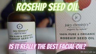 Juicy chemistry Rosehip Seed oil review  Best Facial Oil for oily skin [upl. by Olocin]