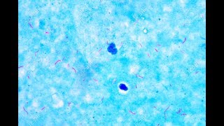 Mycobacterium under microscope afb positive [upl. by Zetes931]