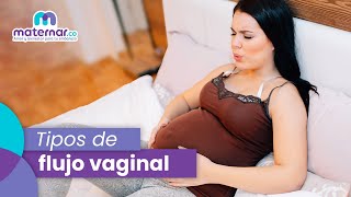 Historia real sobre el flujo vaginal blanco y cremoso [upl. by Lyndy]