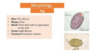 MED Level 2 GIT Diphyllobothrium latum 2 [upl. by Domenico734]