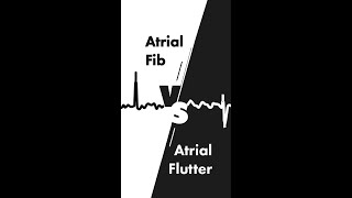 Understanding EKG amp Cardiac Rhythm AFib AFlutter VTach VFib [upl. by Mitchiner358]