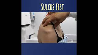 Sulcus Test [upl. by Lonnard]