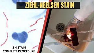 Ziehl Neelsen StainAcid Fast StainZN StainZiehl Neelsen Stain ProcedureAdnanMLT [upl. by Aerdnahs928]