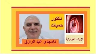 الزوائد القولونية والأورام الحميدة [upl. by Hudnut]