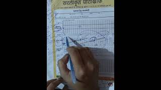 partograph हिंदी में जाने।।।। nursing nursingstudent medicalstudent vidio study aiimsnorcet [upl. by Colier]