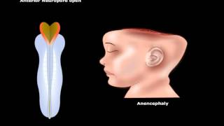 USMLE® Step 1 Neuroscience Development of CNS Animation [upl. by Sherwood459]