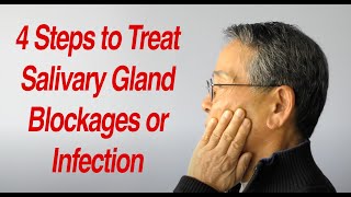 4 Steps to Treat Salivary Gland Swelling at Home [upl. by Laet]