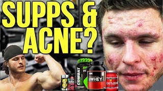 WHICH BODYBUILDING SUPPLEMENTS CAUSE ACNE  Creatine Protein Etc [upl. by Aitas]