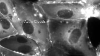 Endothelial microvascular cells [upl. by Blaseio]