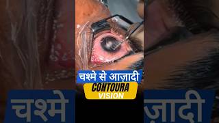 चश्मे से आज़ादी Contoura Vision के साथ [upl. by Laeira804]