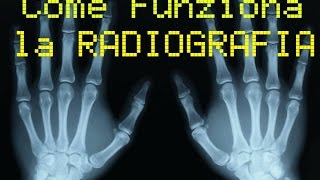 Come funziona la RADIOGRAFIA [upl. by Philemol]