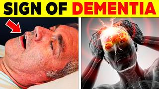 ALERT 15 SIGNS of DEMENTIA that FEW PEOPLE KNOW 115 [upl. by Ellevehc]