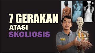 Latihan Untuk MENGATASI SKOLIOSIS Bisa Dilakukan Dirumah [upl. by Kotz]