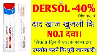 Dersol 40 ointment  Dersol 40 ointment uses  Dersol cream reviewin Hindi दाद खाज खुजली [upl. by Esenej154]