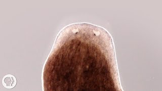 Want a Whole New Body Ask This Flatworm How  Deep Look [upl. by Meyer]