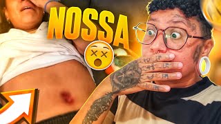 REAGINDO A PIERCING INFLAMADO NO UMBIGO  REACT67 [upl. by Hazen]