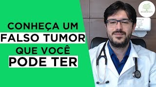 Pseudotumor  O Que é Cefaleia Por Pseudotumor Hipertensão Intracraniana [upl. by Engle]