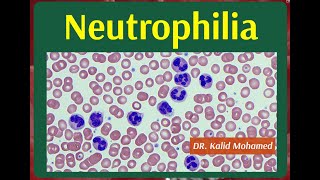 Neutrophilia and Neutropenia Causes amp Evaluation [upl. by Gnivri467]