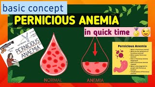 Pernicious anemia  what is anemia  cause  symptoms  treatment [upl. by Anitnelav]