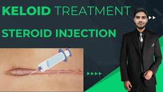 Intralesional Steroid Injection for Keloid Treatment  Trust Medical [upl. by Freyah214]