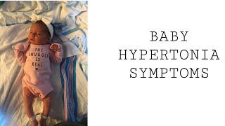 Baby Hypertonia Symptoms [upl. by Idelia580]