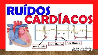 🥇 RUIDOS CARDÍACOS R1 R2 R3 y R4 ¡Fácil Explicación [upl. by Mordy]