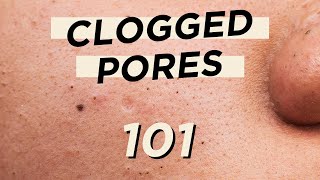 🤭Everything you need to know about CLOGGED PORES • Skincare amp makeup products are not the culprit [upl. by Doralyn]