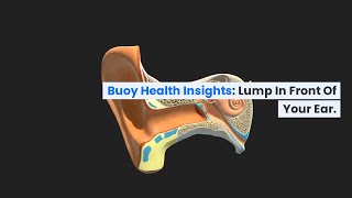 Lumps Behind The Ear Main Causes [upl. by Culbertson]