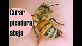 Cómo curar una picadura de abeja [upl. by Nafri]