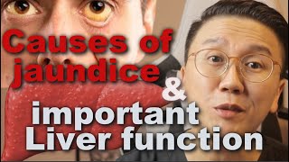 What Causes Yellowing of the Eyes Jaundice and Liver Function Explained  part 1 [upl. by Shushan326]