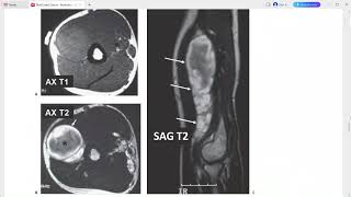 MSK 2 RAD CASE SERIES RADIOLOGY [upl. by Olnee343]