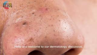 can dermatologist remove blackheads [upl. by Aluap879]