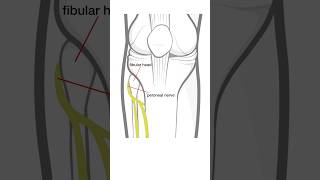 Foot Drop  L5 radiculopathy vs peroneal nerve injury [upl. by Tyrone]