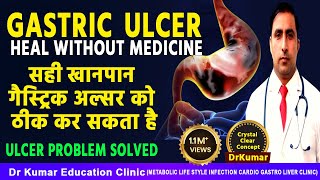 GASTRIC ULCER 7 दिनों में बिना दवा के ठीक करें  Dr Kumar Education Clinic [upl. by Annoynek]