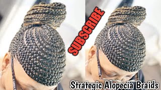 18 AMAZING TOP OF HEAD ALOPECIA COVERAGE BRAID STYLE [upl. by Scott]