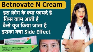 Betamethasone Valerate and Neomycin Skin Cream  Betnovate N Cream for Face  Uses [upl. by Juliet]