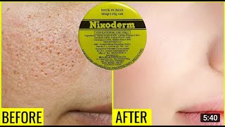 Nixoderm Cream Usage Reviews  Colorful World [upl. by Aneeles469]