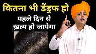 डैंड्रफ जड़ से ख़त्म करने के लिए Get Rid of Dandruff Permanently  Sanyasi Ayurveda [upl. by Ellimac]