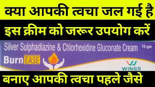 silver sulfadiazine amp chlorhexidine gluconate cream uses in Hindi  born medicine त्वचा जलने की दवा [upl. by Nicks12]