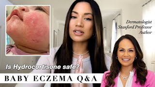 Baby Eczema QampA treatment amp tips from a leading Dermatolgist [upl. by Xet754]