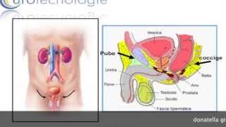 incontinenza dopo prostatectomia [upl. by Aidua933]