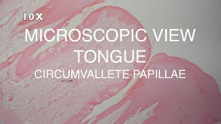 MICROSCOPIC VIEW  TONGUE CIRCUMVALLATE PAPILLAE [upl. by Kartis]