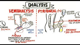 Failing Kidneys and Different Treatment Options [upl. by Amles]