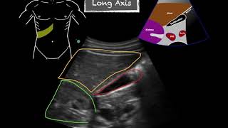 POCUS  Gallbladder Ultrasound Anatomy [upl. by Athey90]